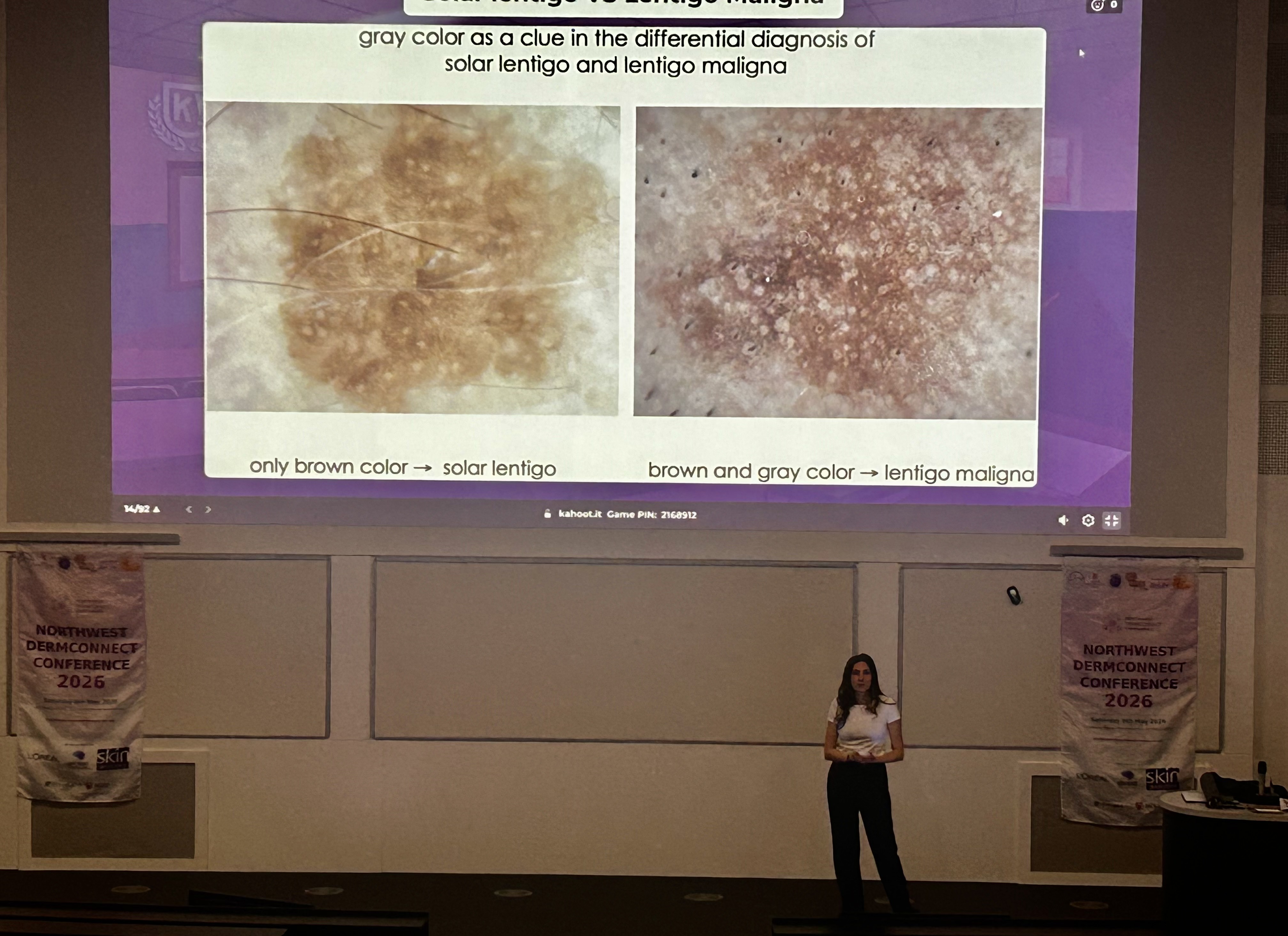 Dermoscopy presentation